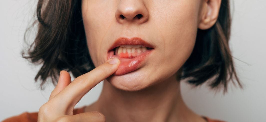 close up shot of a young woman with bleeding gums concept medical negligence dental negligence client