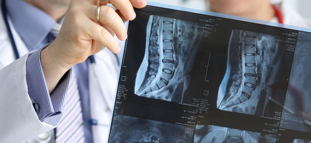 doctor reviewing an x ray concept medical negligence hospital negligence client