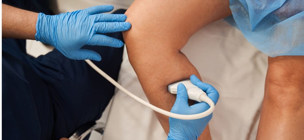 ultrasound of varicose vein surgery in hospital concept representing medical negligence dvt blood clots compensation claims