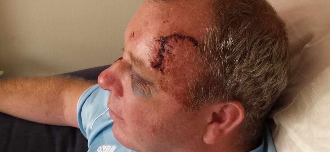 raich carter concept personal injury cycling claims mini hero