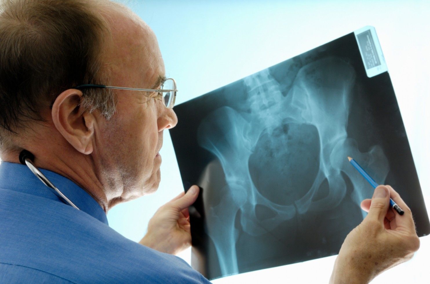 Doctor misses hip x ray