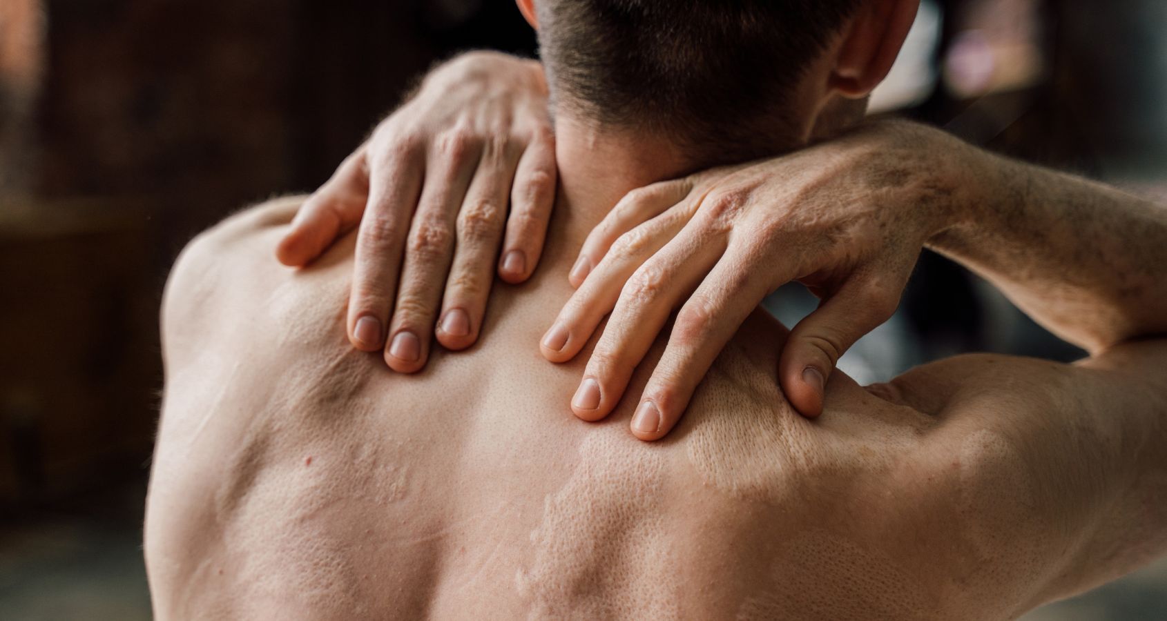 man with burn scars on body touching back concept representing serious injury severe burns and scalds compensation claims