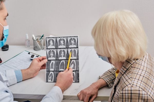 hudgell solicitors represents a woman in her medical negligence claim for the delayed diagnosis of lung cancer