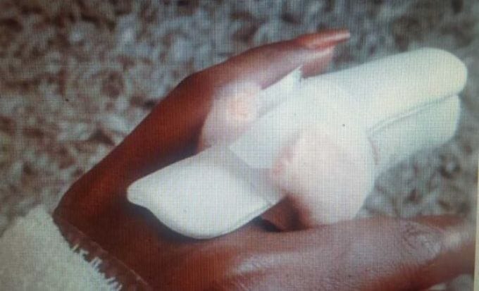 woman’s injured hand concept medical negligence hopsital negligence feature image