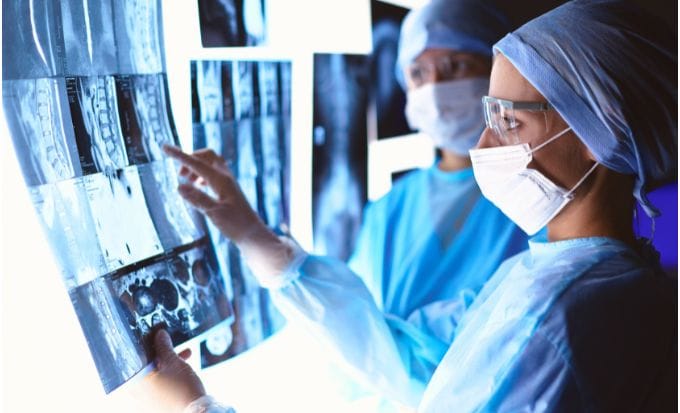 doctors reviewing a spinal x ray concept medical negligence cauda equina feature