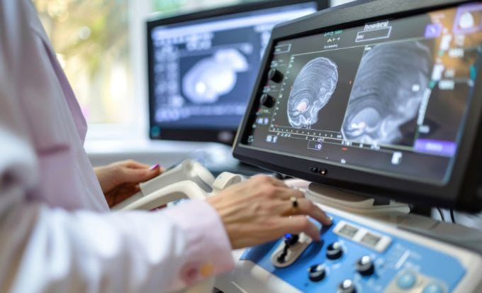 a doctor using ultrasound machine to inspect a babies brain concept birth injury child brain injury feature image