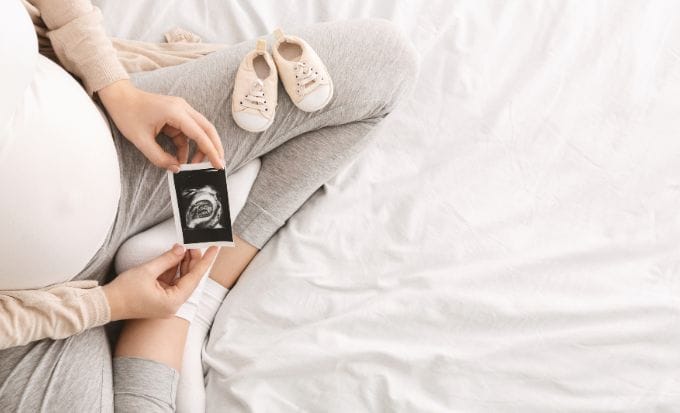 pregnant woman enjoying future motherhood with first ultrasound photo concept medical negligence fatal medical negligence feature image