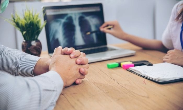 medical diagnosis x ray scan results from professional doctor concept representing medical negligence asbestos mesothelioma compensation claims
